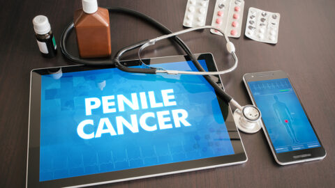 Penile cancer